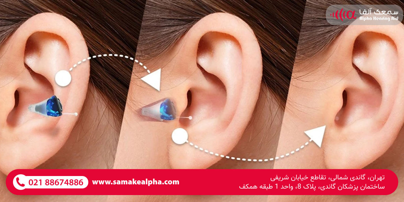 سمعک دیجیتال نامرئی سمعک دیجیتال نامرئی