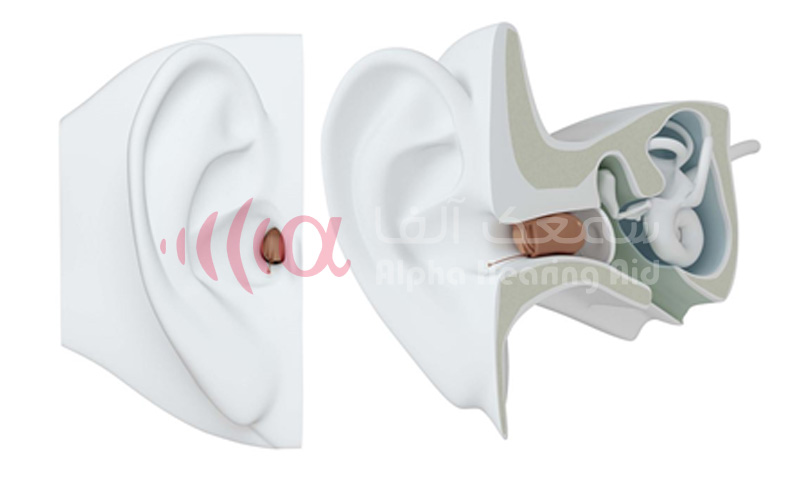 سمعک هوشمند 5 سمعک هوشمند نامرئی IIC