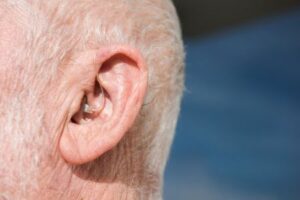 سمعک آلفا 11 سمعک آلفا